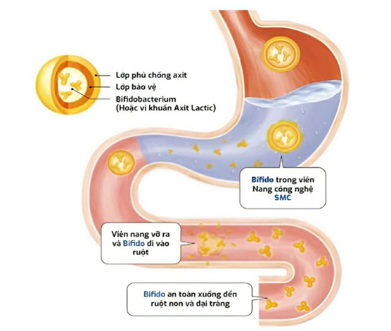 Những biểu hiện của viêm đại tràng tuyệt đối không xem nhẹ