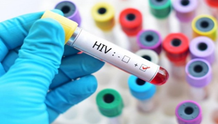 Người nhiễm HIV có trách nhiệm thông báo tình trạng cho vợ, chồng