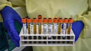 Italy thử nghiệm thành công kháng thể chống virus SARS-CoV-2