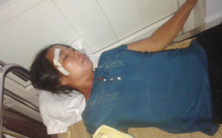 Nghệ An: Cán bộ lâm trường bị dân tố “đánh người”