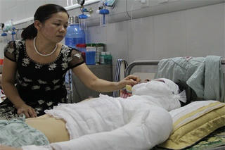 Hà Nội: Nghi án mâu thuẫn tìn ái, sinh viên trường sân khấu bị tạt axít