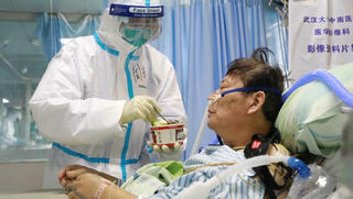 Nghiên cứu từ Trung Quốc: Đàn ông có nguy cơ tử vong do Covid-19 cao hơn phụ nữ