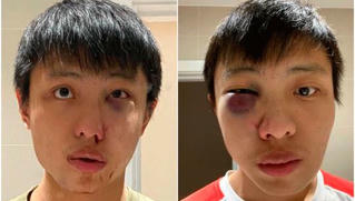 Du học sinh Anh tìm nhân chứng sau khi bị tấn công liên quan đến virus corona