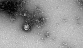 Hình ảnh hiển vi đầu tiên trên thế giới về biến thể mới virus SARS-CoV-2 phát hiện ở Anh