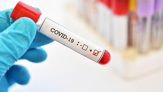 Chinh thức thông báo về 14 ca mới mắc Covid-19 