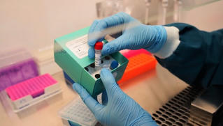 Gộp mẫu để tiết kiệm trong quá trình xét nghiệm SARS-CoV-2