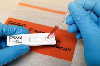 Từ ngày 21/2, mức thanh toán dịch vụ xét nghiệm SARS-CoV-2 mới giảm cao nhất tới 30%