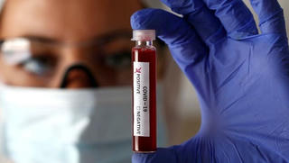 Australia thử nghiệm tiền lâm sàng vaccine phòng bệnh Covid-19