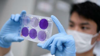 Chuyên gia Pháp dự báo bi quan về triển vọng sớm có vaccine ngừa Covid-19