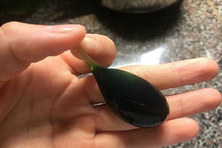 Cứu thành công cháu bé 9 ngày tuổi bị ngộ độc do uống mật khỉ