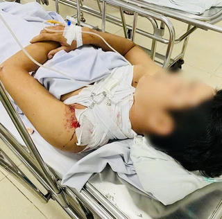 Bình Thuận: Điều tra vụ người can ngăn cãi lộn bị chém