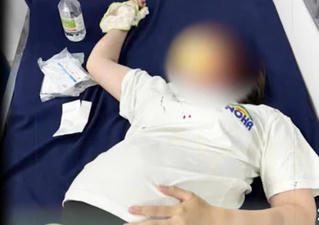 Công an vào cuộc vụ trẻ con giành đồ chơi khiến cho một người phụ nữ mang bầu 8,5 tháng bị đánh ngất xỉu