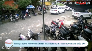 Hà Nội: Người phụ nữ trẻ nhập viện nghi do bị hành hung bằng điếu cày 
