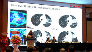 Hội nghị Ung thư Phổi Châu Á 2025: Cơ hội hợp tác nghiên cứu và điều trị ung thư tại Việt Nam