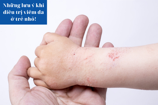 Những lưu ý khi điều trị viêm da ở trẻ nhỏ