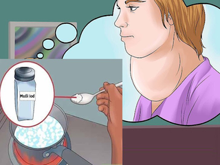 Mách bạn cách cải thiện bướu tuyến giáp an toàn, hiệu quả Mách bạn cách cải thiện bướu tuyến giáp an toàn, hiệu quả