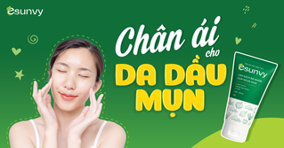 Sữa rửa mặt ngừa mụn Esunvy - 'Chân ái' cho da dầu mụn