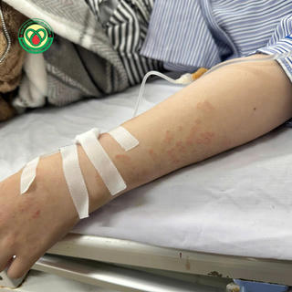 Lần đầu tiên phát hiện ca nhiễm sán máng tại Bệnh viện Bệnh Nhiệt đới Hải Dương