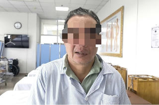 Đang khỏe mạnh, bỗng méo miệng vì lạnh