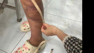 Tạm giữ đối tượng nhiều lần bạo hành vợ đang mang thai và con gái 13 tuổi