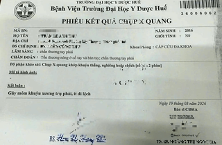 Vụ nữ sinh nghi bị giáo viên tác động: Xem xét lại Kết luận X-quang ban đầu tại BV Trường ĐH Y Dược Huế