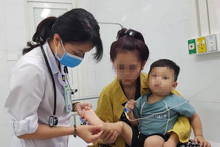 Hà Nội ghi nhận gần 1.600 ca mắc tay chân miệng từ đầu năm