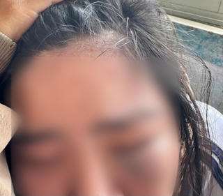 Nữ sinh lớp 7 ở Quảng Ngãi bị nhóm nam sinh đánh hội đồng trước cổng trường