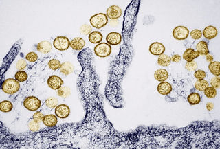 Bản tin tổng hợp 07/05: Bộ Y tế thông tin chính thức về bệnh do virus Hanta