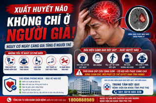 Xuất huyết não ở người trẻ: Đừng chủ quan!