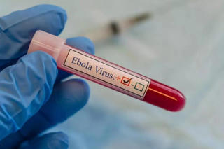 Hà Nội chủ động phòng ngừa nguy cơ dịch bệnh Ebola xâm nhập