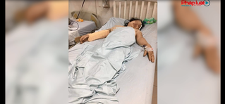 Người phụ nữ bị chồng cũ dùng gậy đánh tới tấp vào đầu