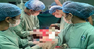 Phẫu thuật thành công cho một phụ nữ có khối u xơ tử cung nặng 5kg