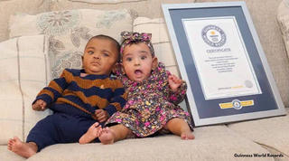 Сặp song sinh đẻ non nhất thế giới đón sinh nhật đầu tiên