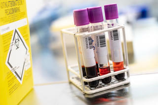 Hơn 300 lọ mẫu virus gây chết người mất khỏi phòng thí nghiệm ở Australia