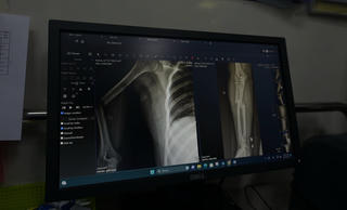 Bản tin sáng 15/09: Người phụ nữ nhảy từ tầng 9 trong vụ cháy chung cư mini đã qua cơn nguy kịch