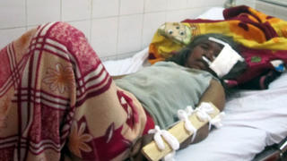 Đi thăm bệnh bằng công nông, 25 người bị hất tung xuống đường