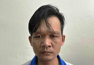 Bắt giữ người chồng tạt axit khiến vợ có nguy cơ mù 2 mắt