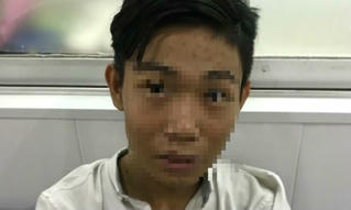 Thiếu niên 16 tuổi hạ sát bảo vệ quán ăn