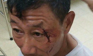 Thanh Thủy, Phú Thọ: Cần sớm làm rõ vụ việc nhóm côn đồ “đại náo” vùng quê