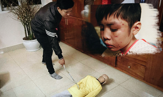 Yêu cầu xử lý nghiêm vụ cháu bé bị bố đẻ và mẹ kế bạo hành