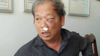 Liên tiếp xảy ra hai vụ nhà báo bị hành hung