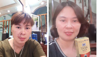 3 sai lầm nghiêm trọng khiến bệnh mỡ máu ngày càng trẻ hóa