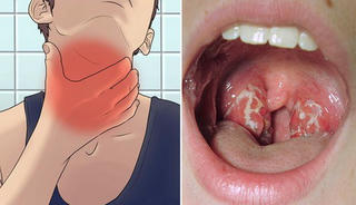 Vắc xin: - Biện pháp phòng ngừa tốt nhất với bệnh bạch hầu