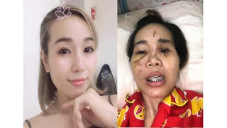 Vụ TNGT làm hai người chết ở Bà Rịa -  Vũng Tàu: Nạn nhân kiến nghị xem xét trách nhiệm người mượn xe