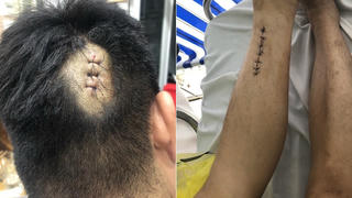 Khánh Hòa: Chậm trễ xử lý vụ án 2 lần chém người suýt chết