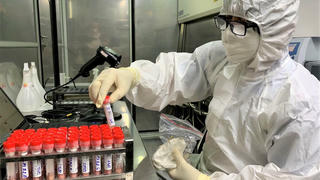 Hướng dẫn thanh toán xét nghiệm COVID-19 trong cơ sở y tế Nhà nước