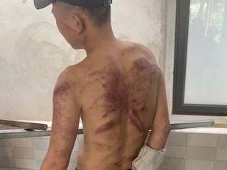 Khởi tố 'nữ quái' cho vay nặng lãi, tra tấn người đàn ông bằng dây điện