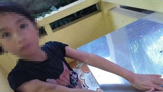 Bé gái 9 tuổi bị cô giáo dạy thêm đánh bầm mặt 