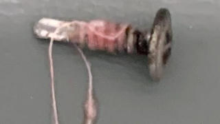 Nuốt phải đinh vít trong lớp học, bé 3 tuổi tử vong