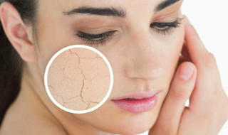 Tuyệt chiêu giúp làn da tránh bị nứt nẻ mùa đông